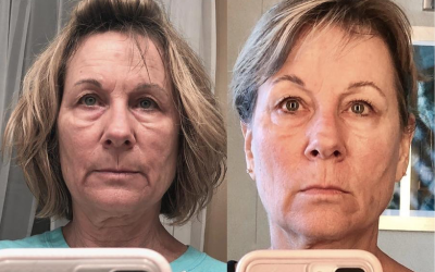 Can Your Skin Care Do This In 7 Weeks?